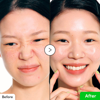 EQQUALBERRY Aloe PDRN Calming Serum