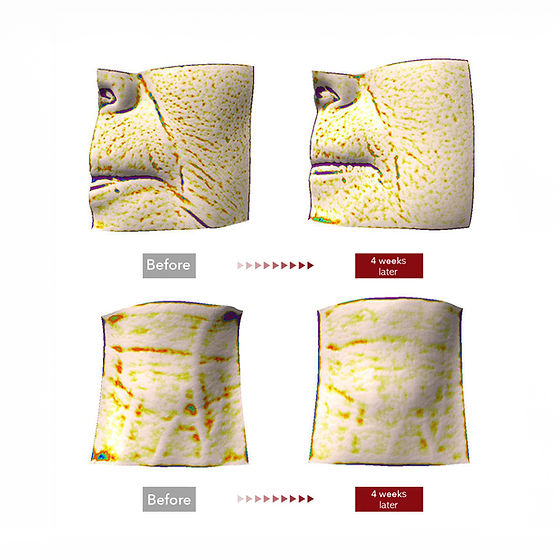 Centellian24 Madeca Cream Time Reverse