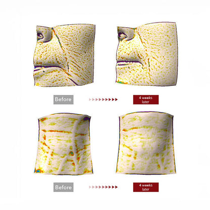 Centellian24 Madeca Cream Time Reverse