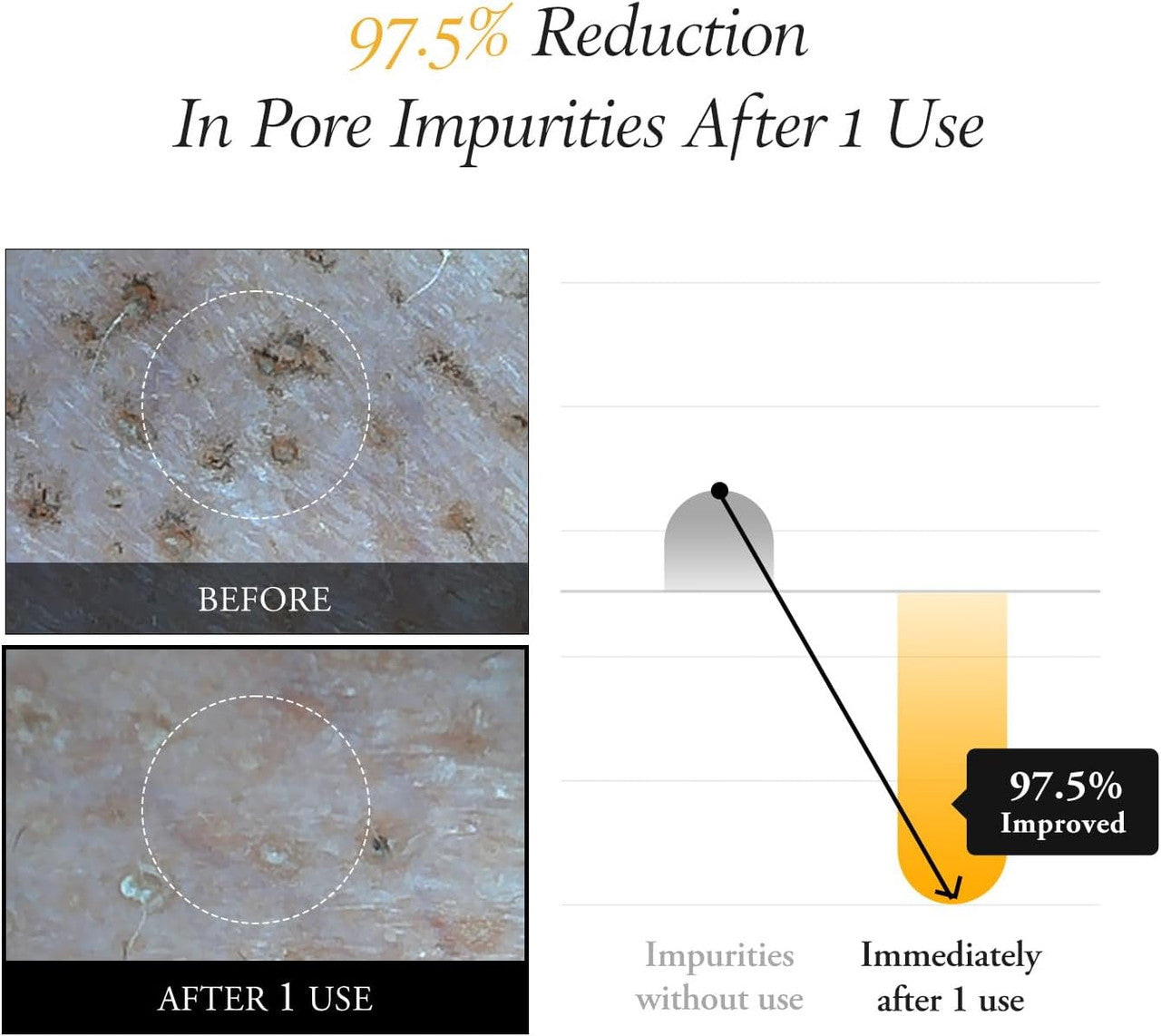 APRILSKIN – Real Calendula Peel Off Pack